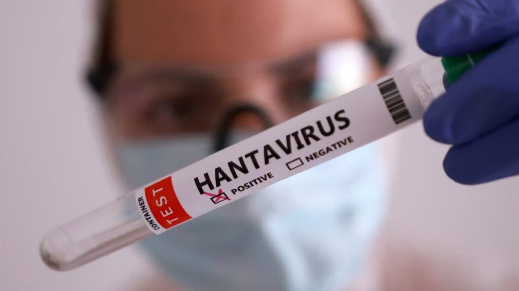 Hantavírus em Santa Catarina: Situação Controlada e Sem Transmissão Entre Pessoas